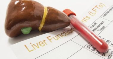 a model of liver on top of a liver function document and vial