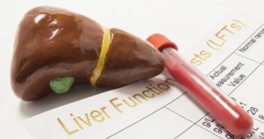 a model of liver on top of a liver function document and vial