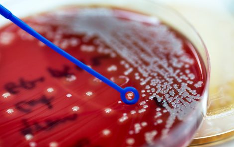 Change in Intestinal Fungus Mix May Contribute to Alcoholic Liver Disease, Study Reports