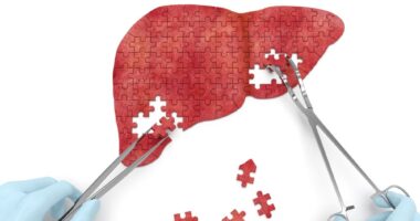 a puzzle of a liver being worked on with a doctor with gloves and forceps