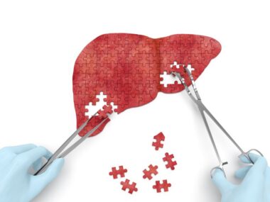 a puzzle of a liver being worked on with a doctor with gloves and forceps