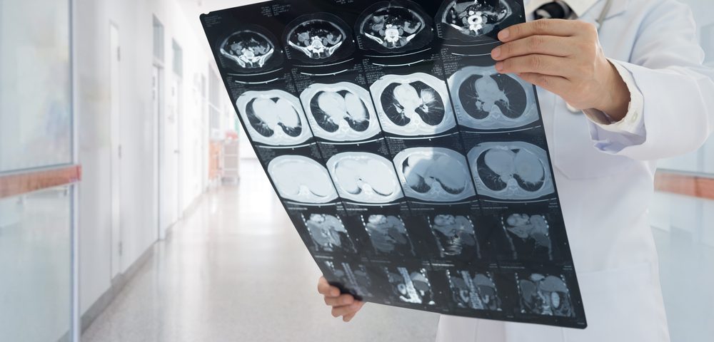 Singapore Researchers Develop Probe That Improves Liver Cancer MRI Imaging