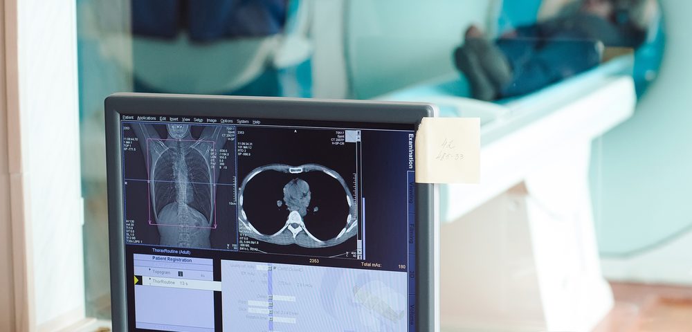 New Data Highlights Advantages of Accuray’s CyberKnife for Treating Liver Metastasis