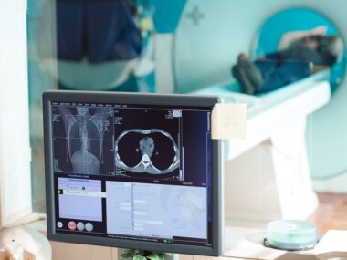 Accuray's CyberKnife