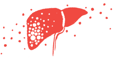 An illustration shows the outline of a liver in red against a white background.