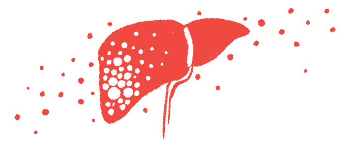 An illustration shows the outline of a liver in red against a white background.