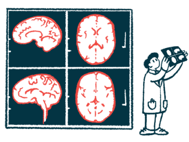 A doctor holds up a slide next to enlarged images of a brain.
