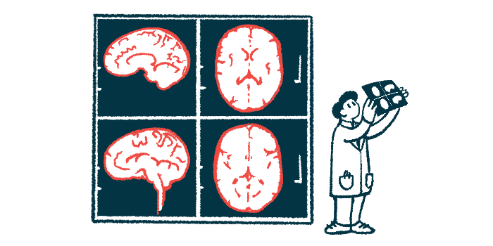 A doctor holds up a slide next to enlarged images of a brain.