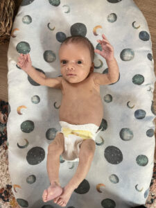 A severely underweight newborn wearing just a tiny diaper lies on a white baby mat with black dots and some lighter crescent shapes, possibly all moons. His arms are raised and he looks right at the camera. The photo is taken from above, looking directly down.