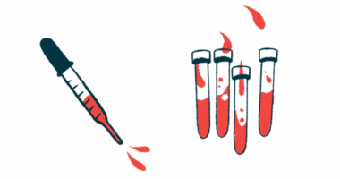 A dropper is shown alongside vials of blood.