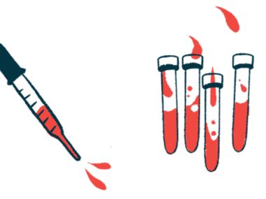 A dropper is shown alongside vials of blood.