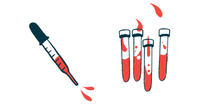 A dropper is shown alongside vials of blood.