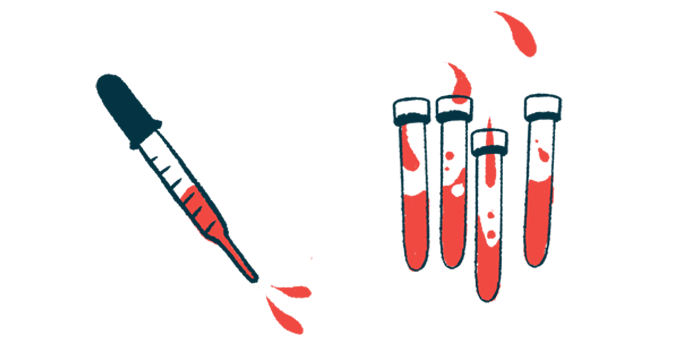 A dropper is shown alongside vials of blood.