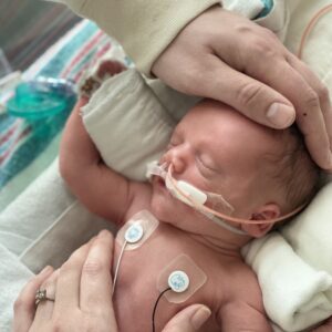 A newborn baby sleeps in a small bed in the neonatal intensive care unit. He has two leads attached to his chest and tubes inserted into his nose. His father's hand rests gently on the top of his head while his mother's hand rests across his stomach. 