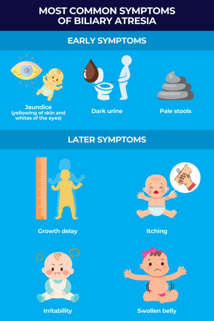 Most common symptoms of biliary atresia