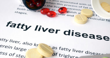 vitamins on top of a fatty liver disease handout