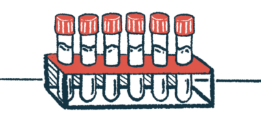 Six capped vials filled with fluid are shown stored in rack.