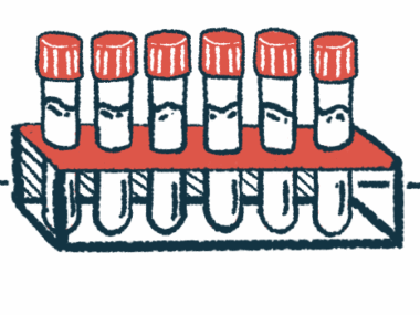 Six capped vials filled with fluid are shown stored in a rack.