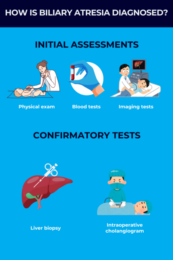 How biliary atresia is diagnosed