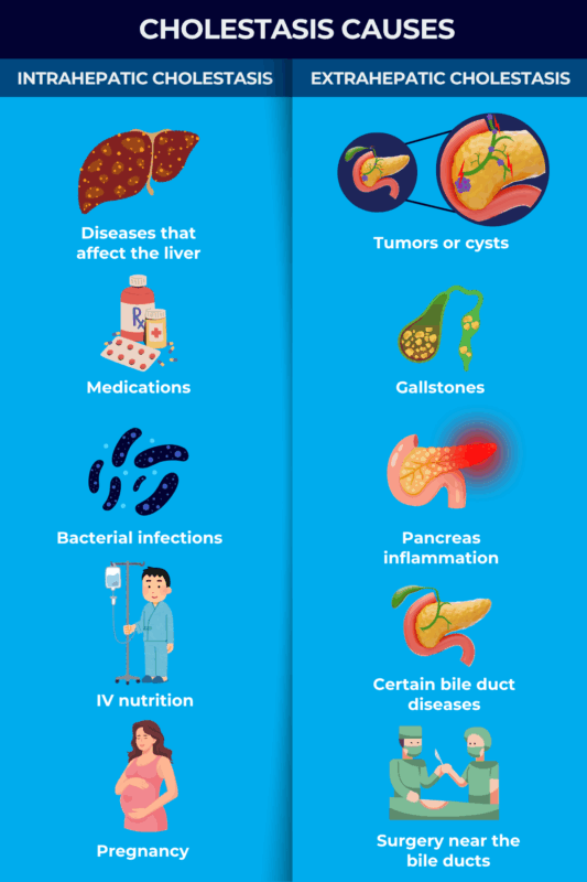 Cholestasis causes
