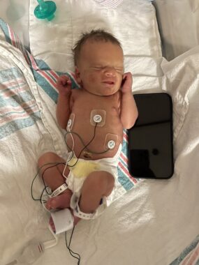 A newborn baby lies in a hospital bed with various wires attached to him. A smartphone is next to him to show his size; the phone is roughly the size of the baby's torso.